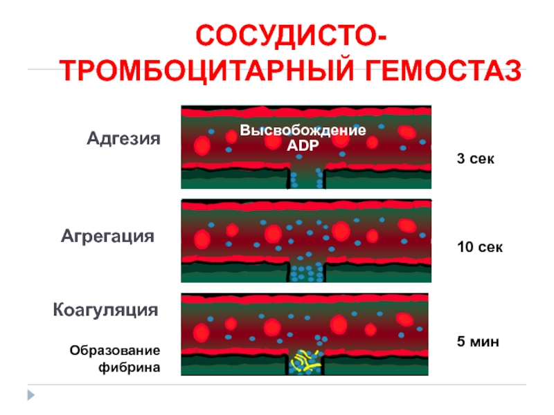 Сосудисто тромбоцитарный гемостаз схема