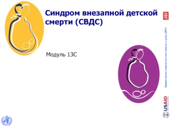 Синдром внезапной детской смерти (СВДС)