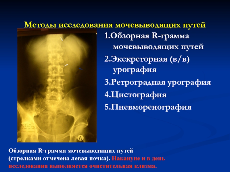 Инструментальные методы исследования почек и мочевыводящих путей презентация