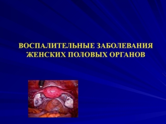 Воспалительные заболевания женских половых органов