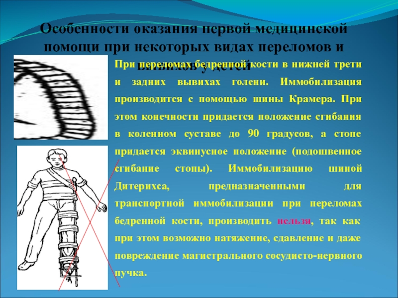 При закрытом переломе бедра необходимо тест. При закрытом переломе бедра необходимо. Особенности переломов костей у детей. Особенности шины Крамера. Травмы опорно-двигательного аппарата.