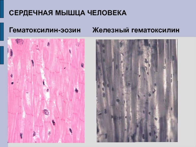 Поперечно полосатая сердечная мышечная ткань гистология рисунок