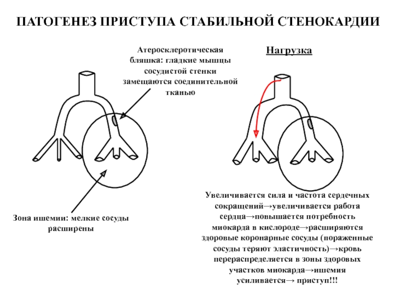 Одна из камер сердечной мышцы