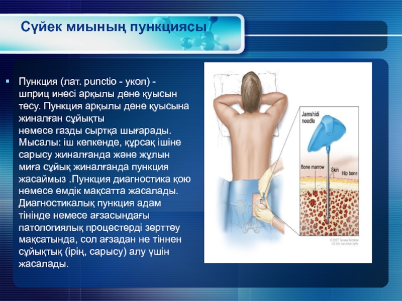 Презентация на тему пункции