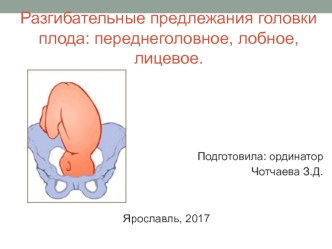 Разгибательные предлежания головки плода: переднеголовное, лобное, лицевое