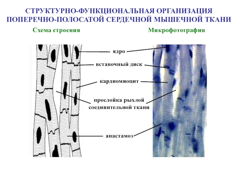 Сердечная поперечнополосатая мышечная ткань рисунок