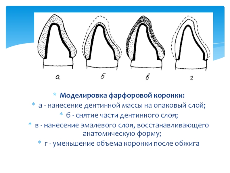 Схема нанесения керамики