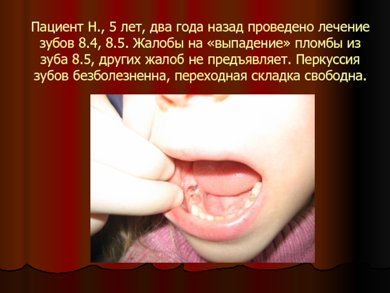 Пациент Н., 5 лет, два года назад проведено лечение зубов 8.4,
