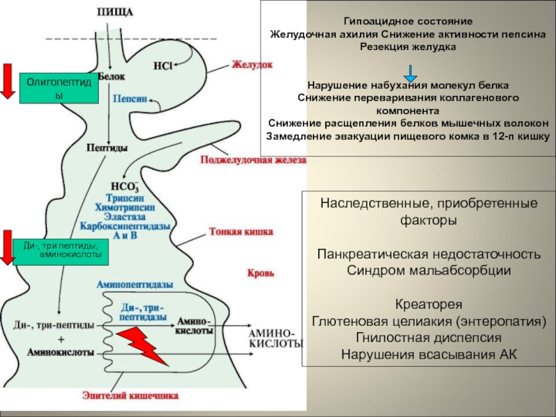 3 пептид. Нарушение всасывания белков в ЖКТ. Ахилия желудка. Нарушение расщепления белка в ЖКТ. Гипоацидное состояние.