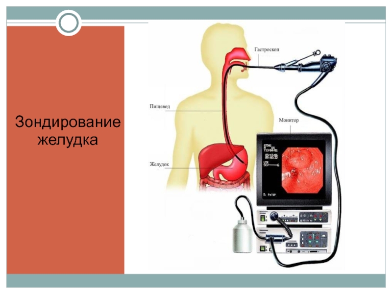 Зондирование желудка. Зондирование желудка для питания. Зондирование желудка у человека. Инструментальные методы исследования при заболеваниях ЖКТ.