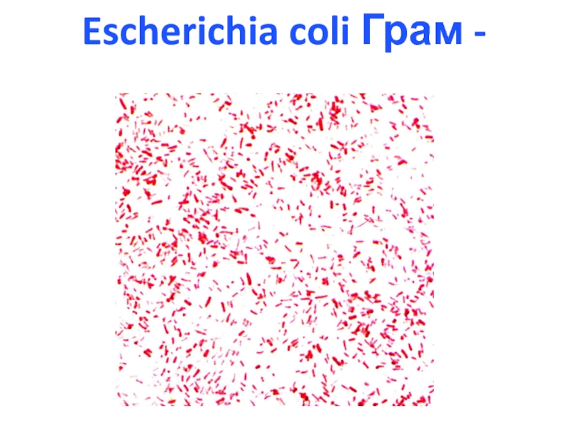 Escherichia coli это