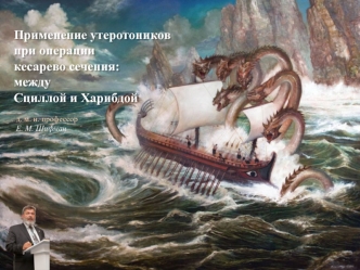 Применение утеротоников при операции кесарево сечения: между Сциллой и Харибдой