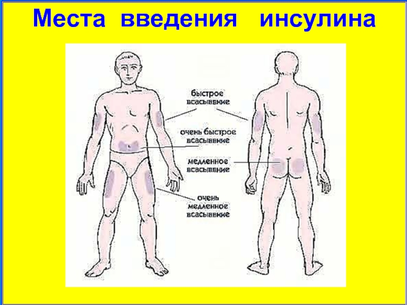 Схема введения инсулина