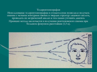 Телерентгенография. Использование телерентгенографии в стоматологии