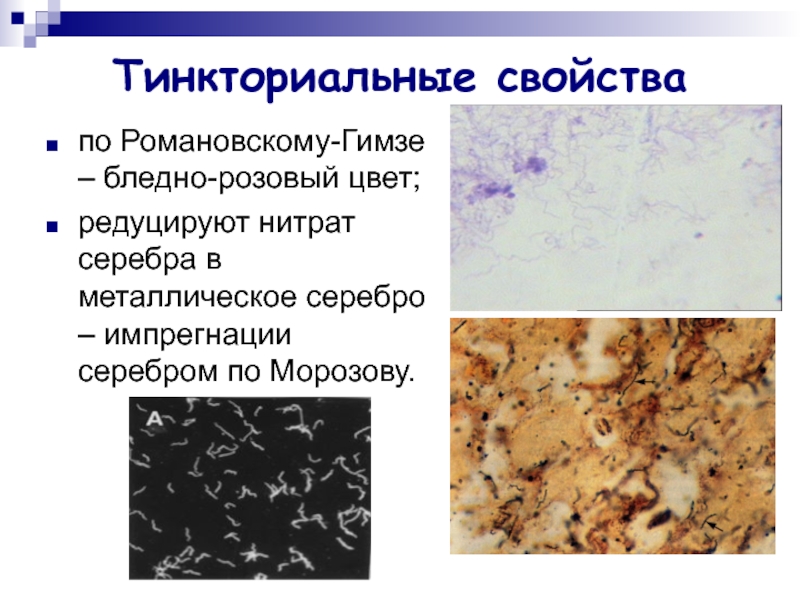 Тинкториальные свойства бактерий. Импрегнация серебром трепонем. Тинкториальные свойства. Тинтереальные свойства. Окраска серебрением по Морозову.