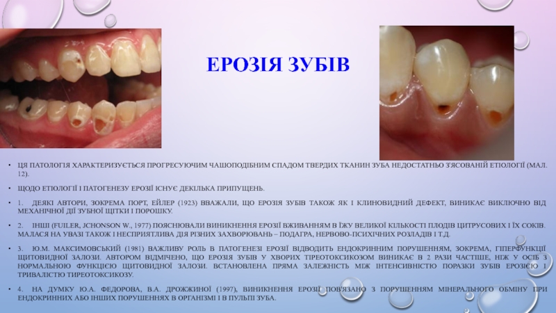 Реферат: Флюороз зубів