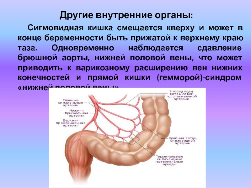 Сигмовидная кишка где находится схема у женщин и как болит