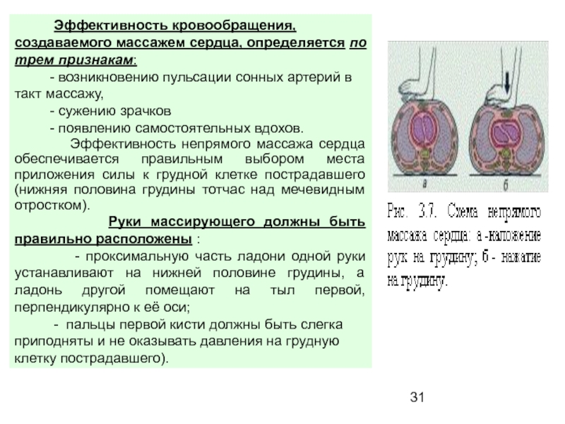 Эффективность непрямого массажа сердца