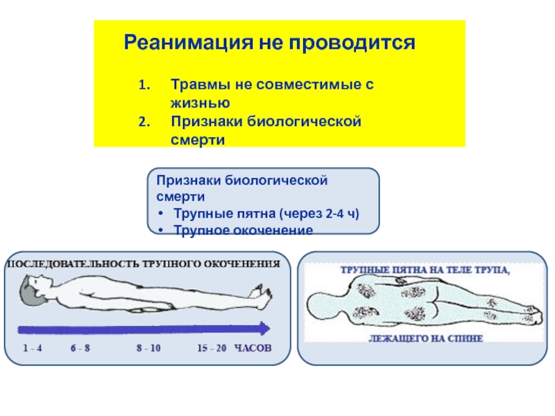 Смерть карта смп