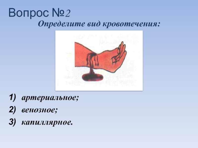 По рисунку определить вид кровотечения окажите помощь из имеющихся подручных средств