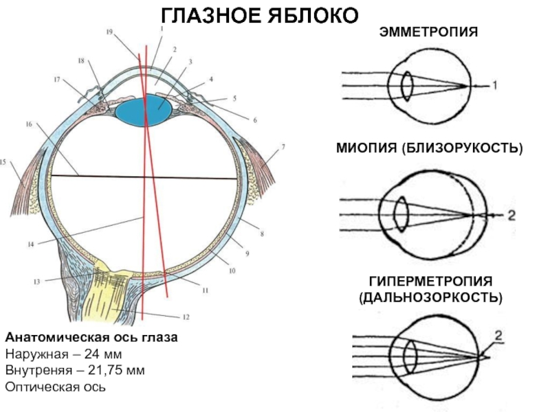 Близорукость какое глазное яблоко