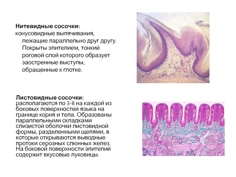 Нитевидные сосочки фото