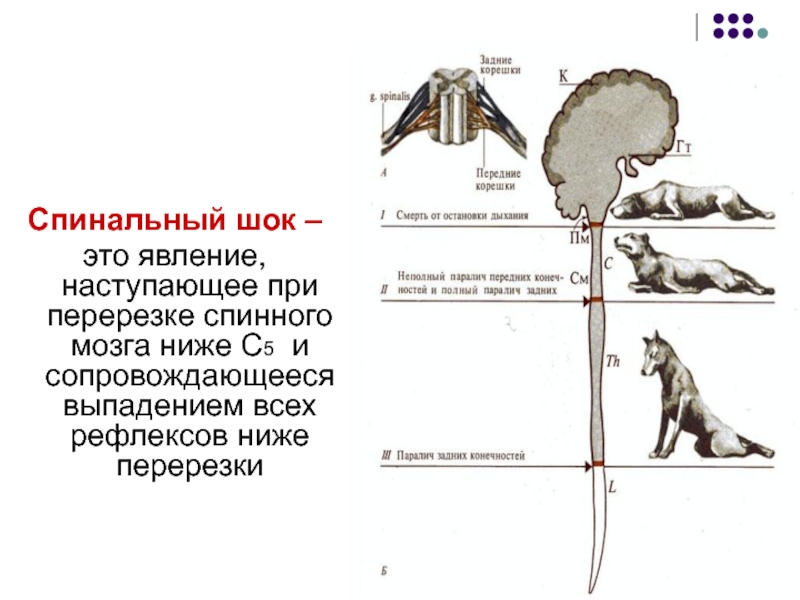 Спинальный шок презентация