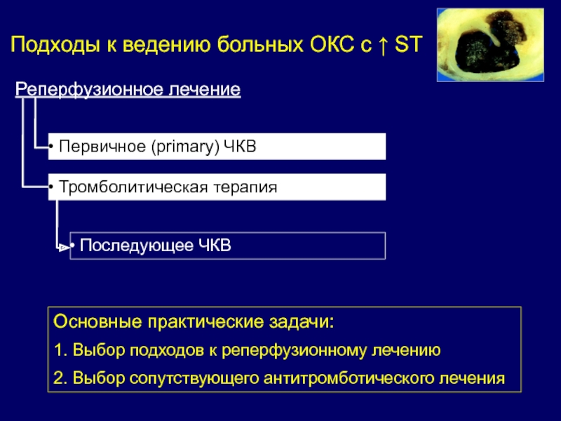 Ведение пациента окс. Тромболитическая терапия при остром коронарном синдроме. Лечение первичное ЧКВ. Оптимальный доступ для ЧКВ это тест. Паландт (основной практический комментарий Германии).