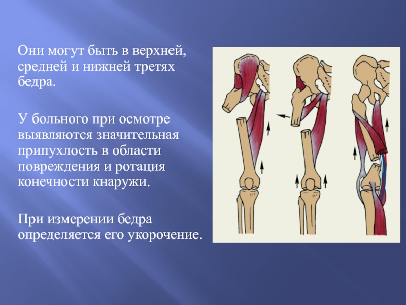 Повреждения нижних конечностей презентация