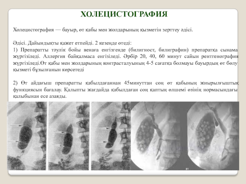 Холецистография направление образец