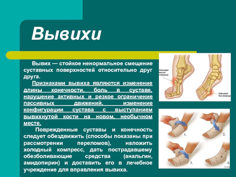 Растяжение связок карта вызова