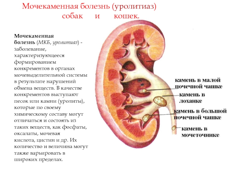 Уплотнение члс обеих почек