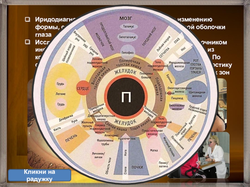 Иридодиагностика фото с расшифровкой