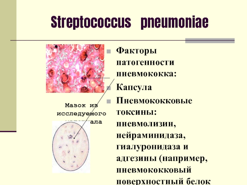 Корь факторы патогенности. Факторы патогенности СПИД. Факторы патогенности туляремии. Гепатит д факторы патогенности.