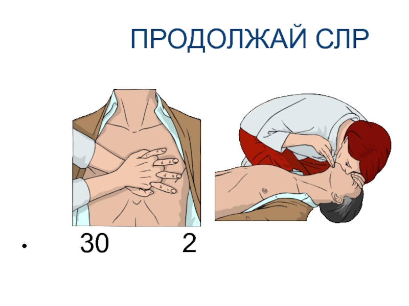 Компрессия у детей при слр. Сердечно-легочная реанимация 30 к 2.