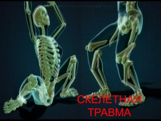 Скелетная травма