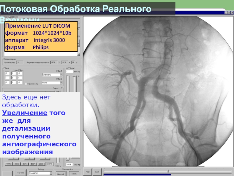 Обработка нет. Dicom Формат. Медицинские приборно-компьютерные системы. Интегрис программа для рентгена. Функций формата Dicom.