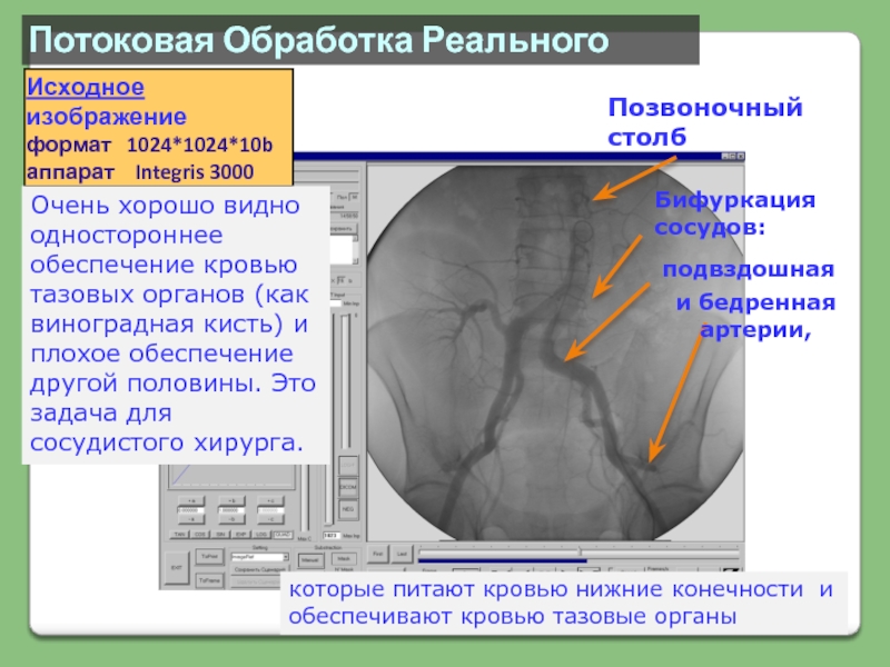 Обработка в реальном времени. Медицинские приборно-компьютерные системы. Обработка потоков. Интегрис программа для рентгена. Integris.