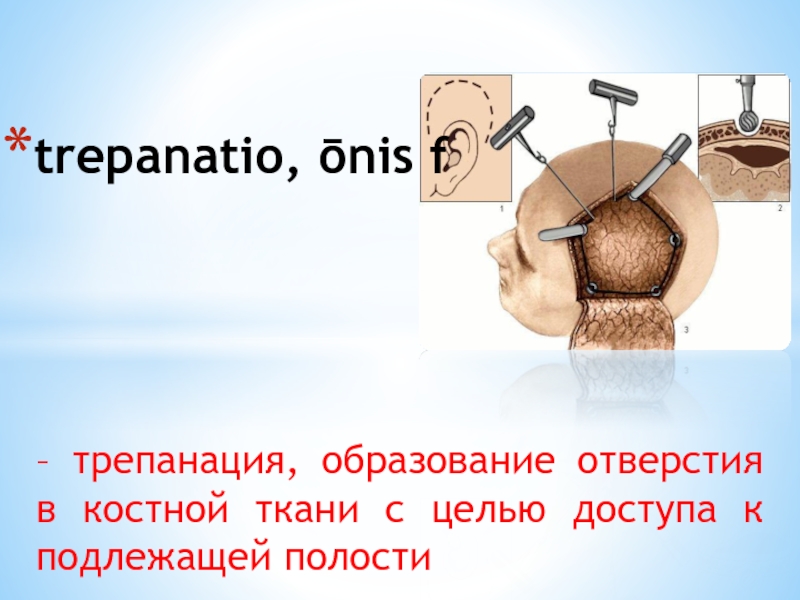 Опухоль на латинском. Названия хирургических вмешательств на латыни. Трепанация Лидия Мартин. Трепанация черепа Лидия Мартин.