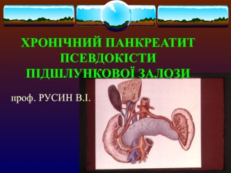 Хронічний панкреатит. Псевдокісти підшлункової залози