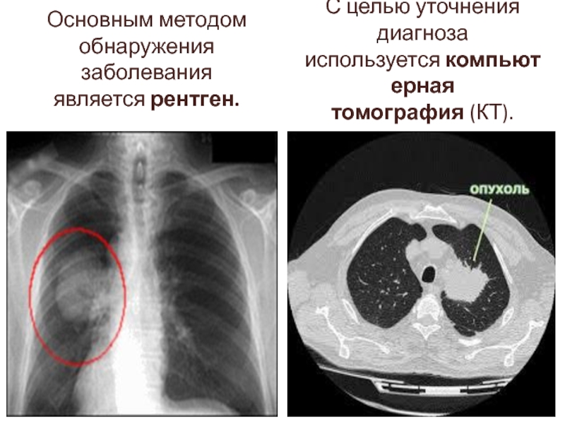 С целью уточнения диагноза. Какие диагнозы считаются рентгенологическими. Рентгенограмма стали.