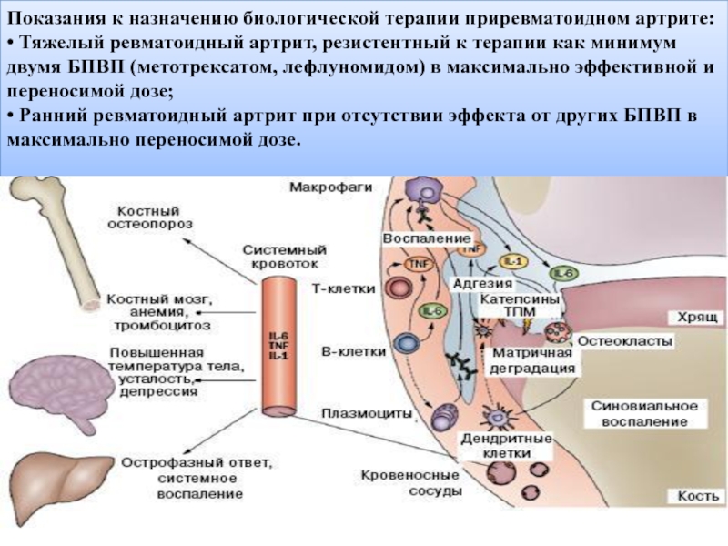 Схема приема метотрексата при ревматоидном артрите