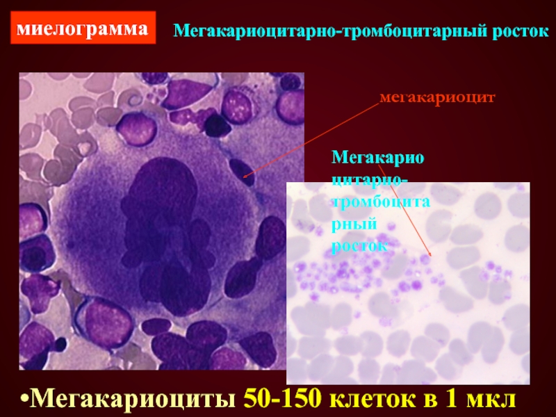 Мегакариоцитарно-тромбоцитарный ростокмегакариоцитМегакариоциты 50-150 клеток в 1 мклмиелограммаМегакариоцитарно-тромбоцитарный росток