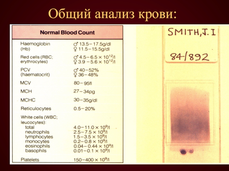 Общий анализ крови: