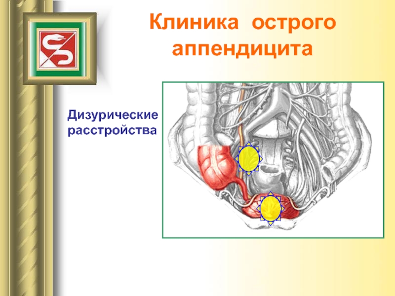 Карта вызова острый аппендицит