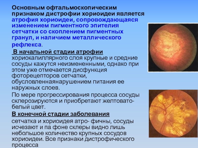 Аллопластическая картина болезни это