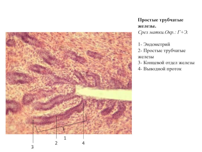 Трубчатая железа. Простые трубчатые железы срез стенки матки. Простые трубчатые железы срез. Простая трубчатая железа. Простая трубчатая железа матки.