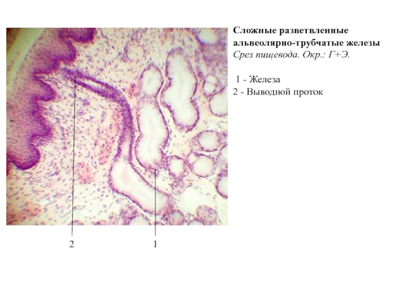 Сложная железа. Сложная альвеолярно-трубчатая железа срез пищевода. Сложная альвеолярно-трубчатая железа пищевод гистология. Разветвленные альвеолярно-трубчатые железы. Сложные разветвленные альвеолярно-трубчатые железы.