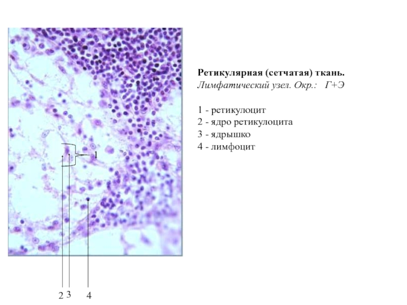 Ретикулярная ткань фото