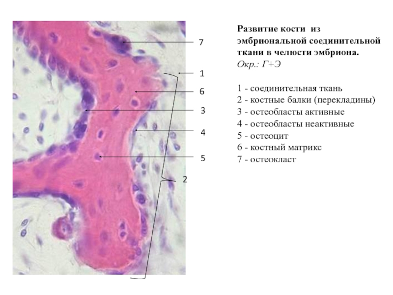 Развитие кости на месте хряща гистология рисунок